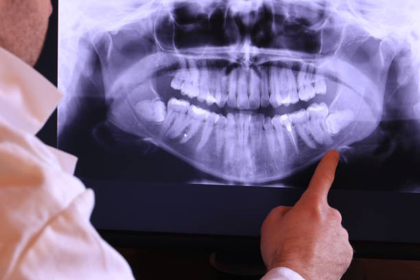 Best Broken or Cracked Tooth Emergency Dentist in Van Buren, MO