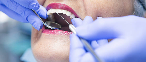 Best Emergency Dental Care for Abscessed Tooth in Van Buren, MO