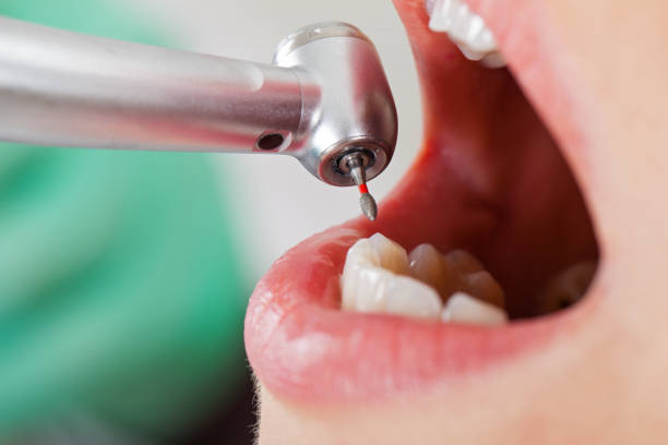 Best Urgent Dental Care for Toothache in Van Buren, MO